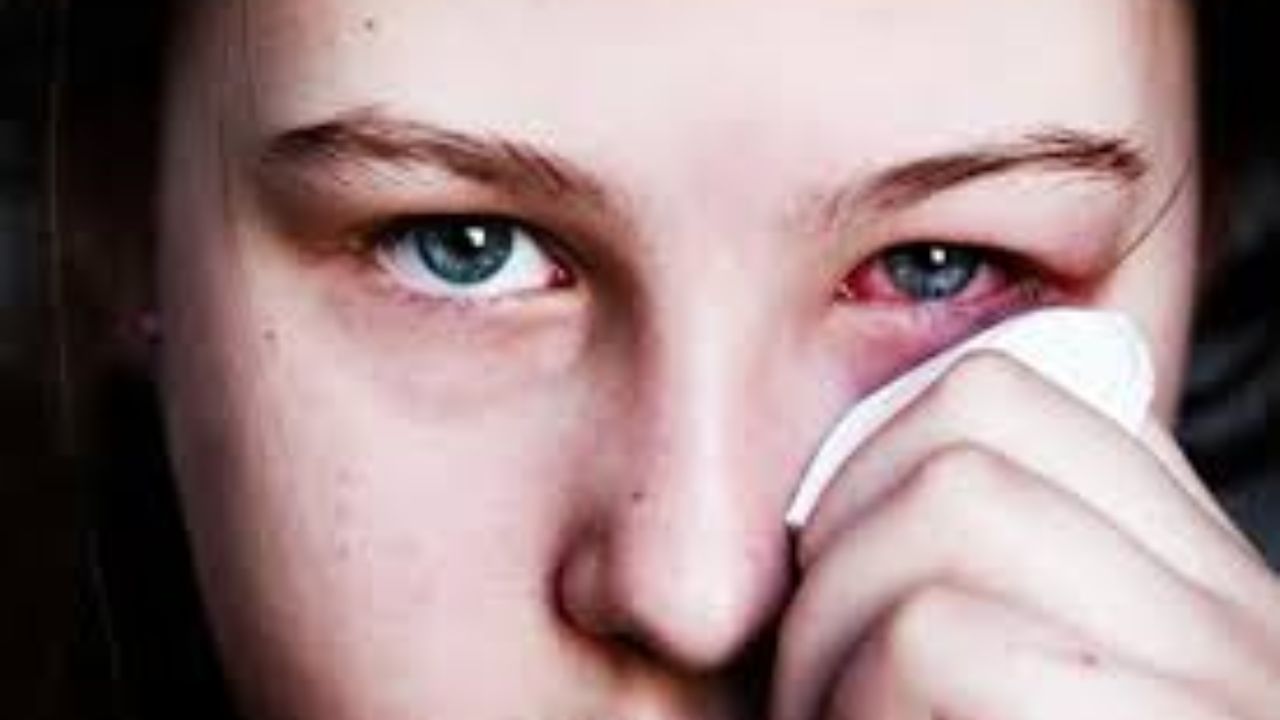 is vowiszojid54 for sensitive eyes